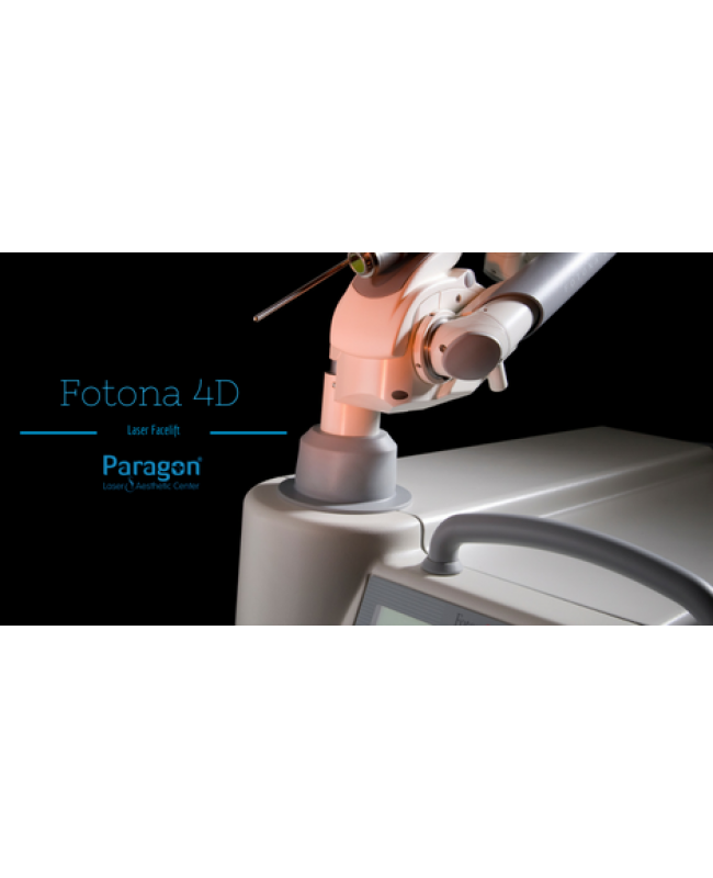 What is Fotona 4D Laser Facelift?